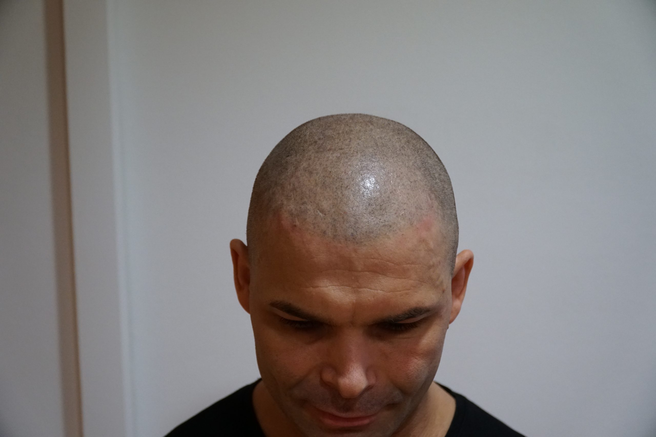 Torneo de barberos Parte 2